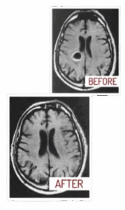Meridian Health Protocol Benefits